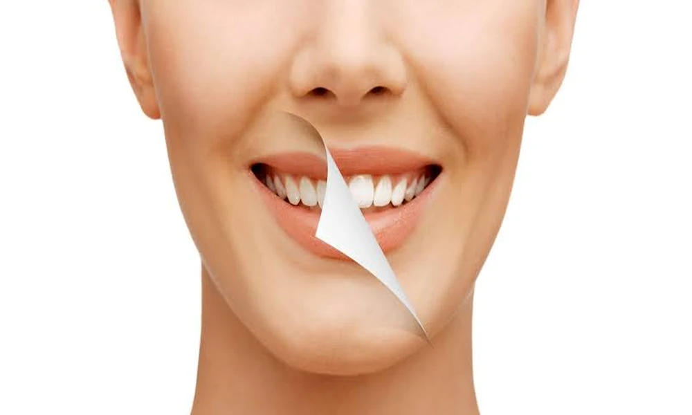 Smile Makeover: The Role Of Cosmetic Dentists