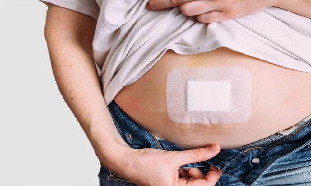 Hernia Repair North Andover MA: Trusted Surgical Care for Lasting Relief